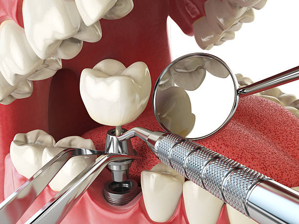 Best Weekend Emergency Dentist in Eudora, KS